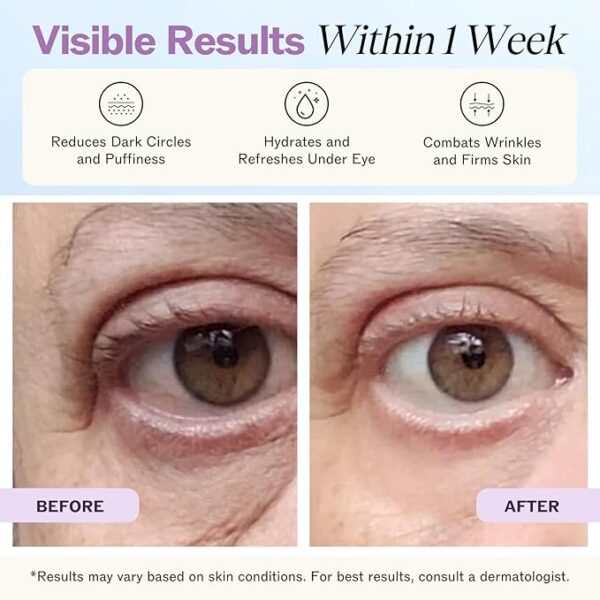 LilyAna Naturals Eye Cream - Image 3